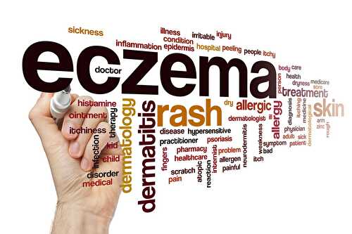 Can Stress Cause Eczema?
