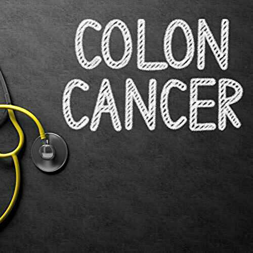 Top 10 Causes Colon Cancer?
